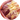 Перитонит
