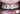 Cerec 3D до и после_2