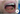 Cerec 3D до и после_4