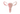 аденомиоза что это