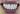 Cerec 3D до и после_3