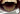 Cerec 3D до и после_4