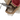 Костная пластика