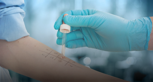 Аллергология и иммунология